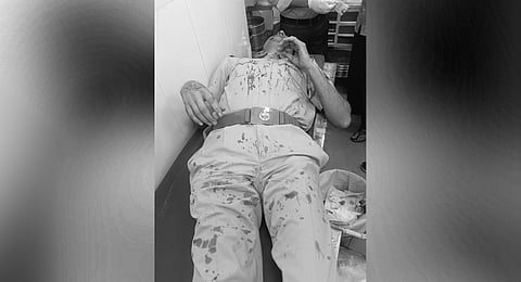 Officer Mukesh Sepat suffered severe head injuries and required stitches following the villagers' attack. 