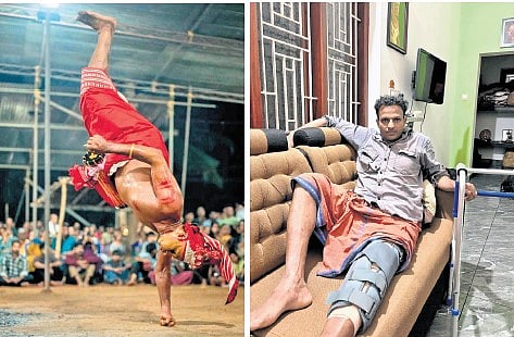 Shanu Peruvannan during a captivating theyyam performance  (R) Shanu with his 
injured leg 