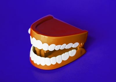 When oral cancer mimics a simple ulcer: Rare tongue cancers that delay diagnosis 