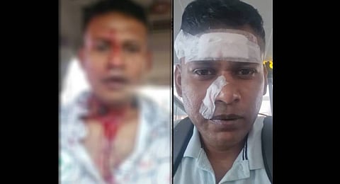 Indian Air Force Wing Commander Shiladitya Bose is booked in an attempt to murder case under section 109 of the BNS.
