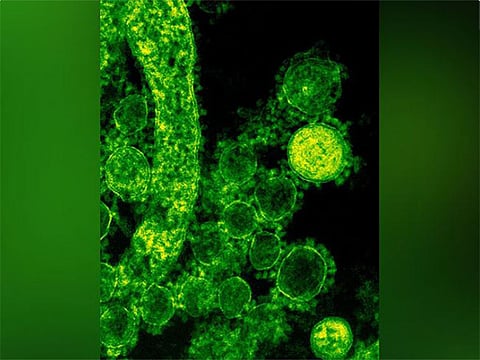 Nipah virus