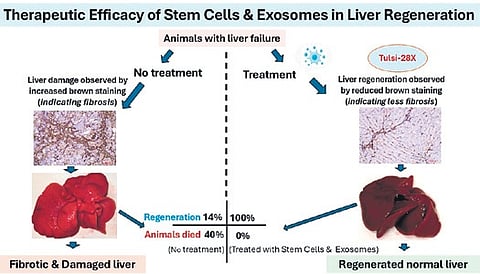 Chronic liver failure accounts for nearly 20% of all liver-related deaths globally, with liver transplantation being the only treatment.