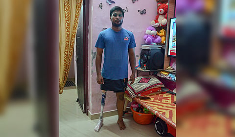 Following medical treatment, the state government provided The victim, G Princeton with a Rs 7.5-lakh-worth prosthetic leg, with a hydraulic knee joint, made by a German manufacturer. 