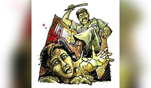 The victim claimed that he was tortured with candles, beaten, and robbed of money.