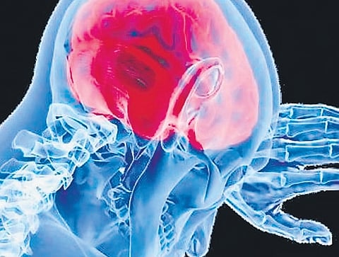 Amoebic meningoencephalitis is among the deadliest infections worldwide, with a 97% global mortality rate. 