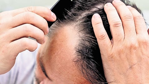 Notably, the study has also identified the role of cholesterol intermediates in governing hair follicle regeneration.