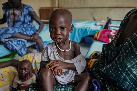 Adut Duor, 14 months old, sits on his mother's lap in the malnutrition ward of Bunj Hospital in Maban, South Sudan, Monday, Aug. 18, 2025. 