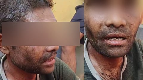 Ramnarayan Bhayar  was lynched on false theft charge, abandoned for hours: Autopsy confirms Bhayar died of severe assault; five held, SHRC seeks report