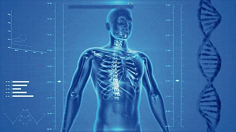 Fibrodysplasia Ossificans Progressiva disorder builds a second skeleton