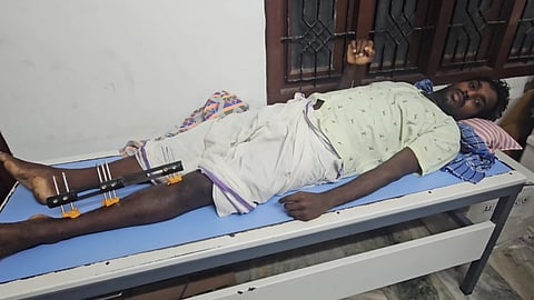 P Manikandan, a palm tree climber from Tenkasi who was shot by a police sub-inspector, sought financial assistance from the state government to cover his medical expenses. 
