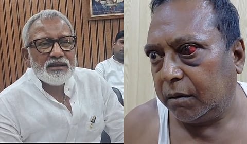 Sri Ganganagar BJP MLA Jaideep Biyani and RUIDP Asst Engineer Jaganlal Bairwaa 