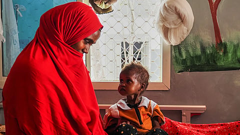 A mother looks at her daughter, who is suffering from severe acute malnutrition, at a stabilization center in a hospital in Qardho, Puntland, Somalia, Friday, April 17, 2026.