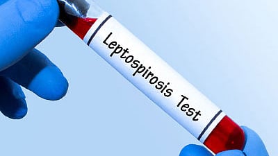  leptospirosis