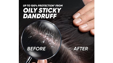 What Your Oily Scalp Is Trying to Tell You