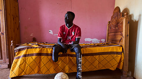Omer al-Toum, 33, who lost his leg and arm by the explosion of unexploded ordnance, sits in his bedroom in Bahri, on the outskirts of Khartoum, Thursday, April 23, 2026.