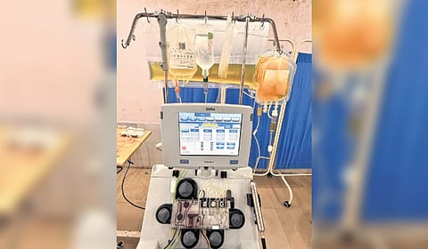 The plasma exchange machine.