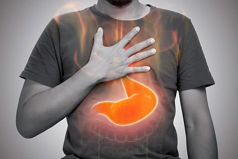 No Heartburn, Still Reflux, The ‘Silent’ Condition Affecting Your Throat & Voice