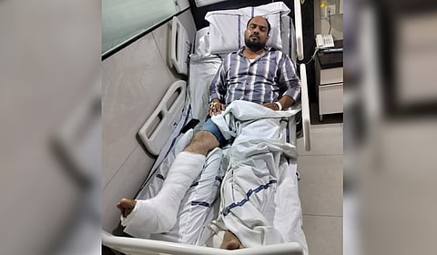 Constable Mahender Yadav sustained a leg fracture in the incident.