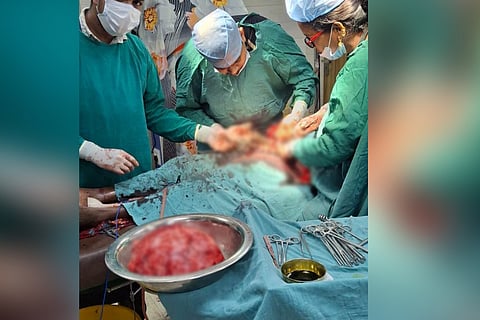 The patient had been suffering from severe pain, difficulty in walking and breathing, breathlessness and fatigue for several years without realising that a giant tumour was growing inside her uterus