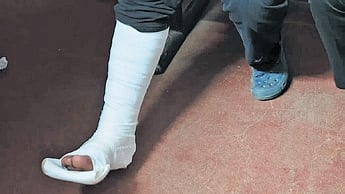 The victim sustained serious injuries on his leg and had to get a cast