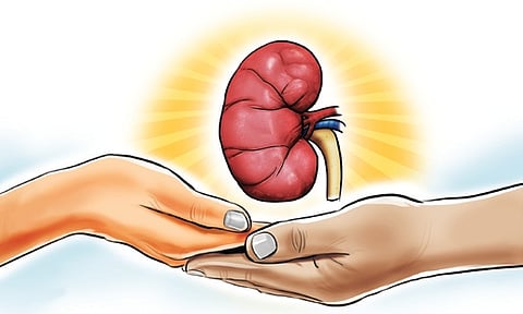 Representative image