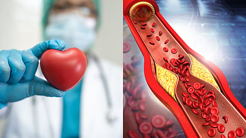 Most dangerous risk factors for the heart show no symptoms 