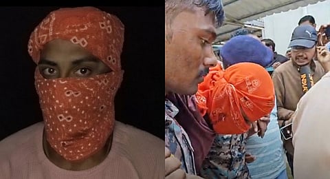 Nandan Yadav, the main accused suffered a gunshot wound to his leg. 