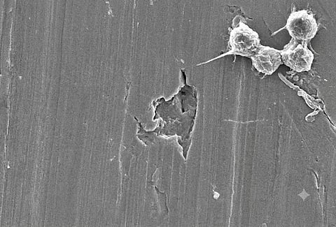 Tiny amoeba survives heat beyond complex life’s limits