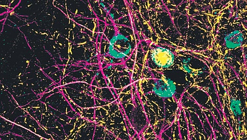 Scientists (right) working on a study on the molecular mechanism (above) through which RNA virus infections may accelerate the formation of amyloid clumps associated with Parkinson’s.
