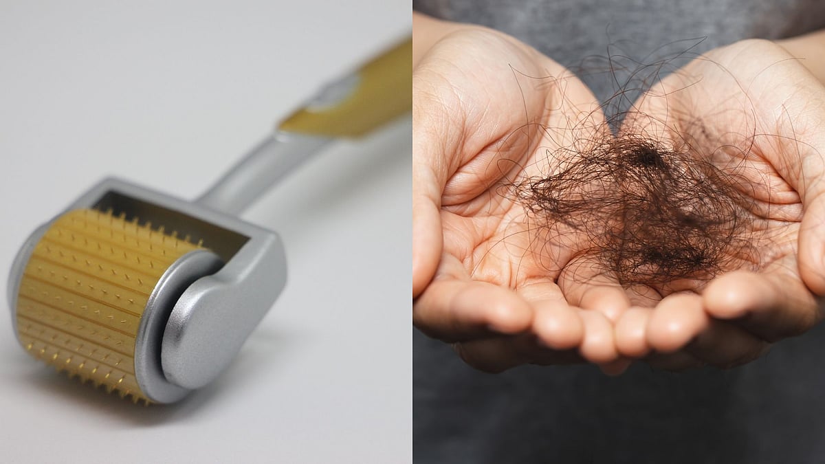 Dermatologists Say Diagnose Hair Fall Before Treating It