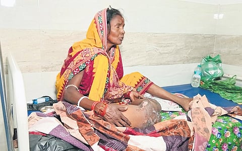 The injured kid undergoing treatment in hospital at Cuttack.