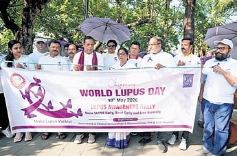Early diagnosis, timely care, lifestyle changes can help battle lupus: Experts