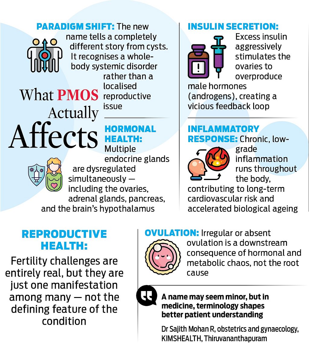 ‘Cyst’ myth busted: PCOS is now PMOS