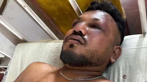 അഹമ്മദാബാദ് വിമാനാപകടത്തില്‍ നിന്ന് രക്ഷപ്പെട്ട വിശ്വാസ് കുമാർ രമേശ്