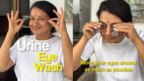 Urine eye wash trend gone wrong