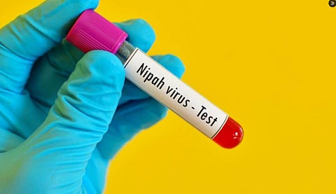 nipah virus, Palakkad, നിപാ