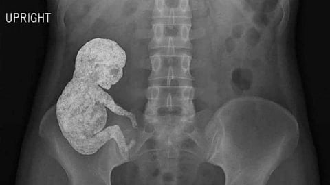 BABY STONE