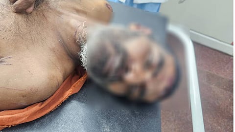 പരിക്കേറ്റ സുദർശൻ