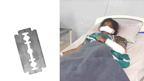 ഭര്‍ത്താവിന് സംശയ രോഗം; ബ്ലേഡ് കൊണ്ട് ഭാര്യയുടെ മൂക്ക് മുറിച്ചു 