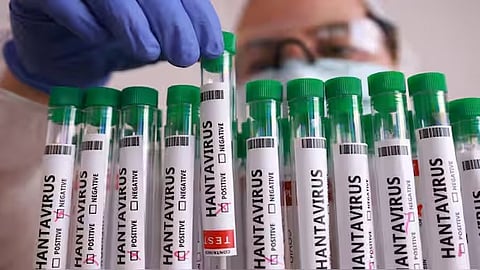 ഹാന്റാ  വൈറസ് വ്യാപനം; എംവി ഹോണ്ടിയസ്  കപ്പലില്‍ നിന്ന് യാത്രക്കാരെ ഒഴിപ്പിക്കാൻ നടപടി