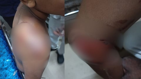 കൊല്ലത്ത് കണ്ണില്ലാത്ത ക്രൂരത; മകൻ്റെ ദേഹമാസകലം പൊള്ളലേൽപ്പിച്ച് പിതാവ്