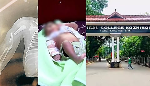 "ചികിത്സാ പിഴവുണ്ടെങ്കില്‍ നടപടി സ്വീകരിക്കും"; മെഡിക്കല്‍ കോളജില്‍ പ്രസവത്തിനിടെ കുഞ്ഞിന്റെ കൈ ഒടിഞ്ഞതില്‍ ചൈല്‍ഡ് ഹെല്‍പ്പ് ലൈന്‍
