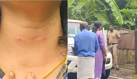 റോഡില്‍ വെള്ളമൊഴുകുന്നത് മണ്ണിട്ട് തടഞ്ഞത് ചോദ്യം ചെയ്തു; യുവതിയെ ഇരുമ്പ് ചൂല് കൊണ്ട് ആക്രമിച്ച് അയല്‍വാസി