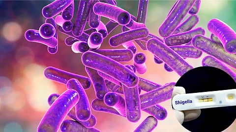 Two people in Thiruvananthapuram test positive for Shigella