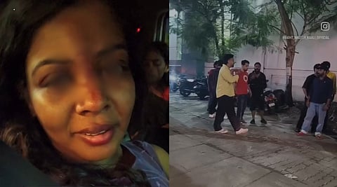 കൊച്ചിയിൽ സിനിമയിലെ ഫൈറ്റ് മാസ്റ്ററായ യുവതിക്ക് നേരെ ആക്രമണം; മർദിച്ചത് ലഹരിമരുന്ന് കേസ് പ്രതിയും സംഘവും