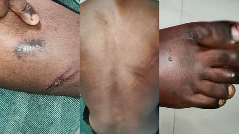 'കുട്ടികളെ മർദിക്കുന്നത് നേരിട്ട് കണ്ടു'; എലോഹിം ഗ്ലോബൽ വർഷിപ്പ് സെൻ്ററിലെ പീഡനത്തിൽ സിഡബ്യുസിക്ക് മൊഴി നൽകി അന്തേവാസികൾ