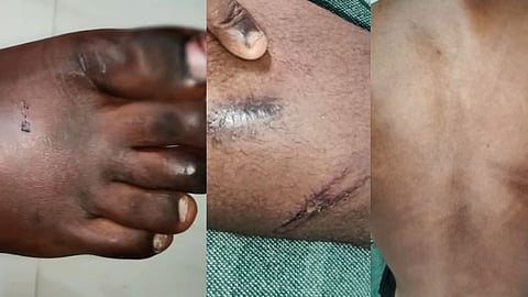 പത്തനംതിട്ട അഗതി മന്ദിരത്തിലെ ബാലപീഡനം: മൂന്ന് പ്രതികൾ അറസ്റ്റിൽ