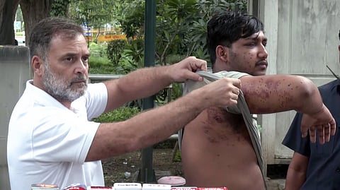 സമരക്കാര്‍ക്കെതിരായ പെല്ലറ്റ് ഗണ്‍ ഉപയോഗം; നിർദേശം നല്‍കിയത് ഡിസിപി റാങ്കിലുള്ള ഉദ്യോഗസ്ഥന്‍