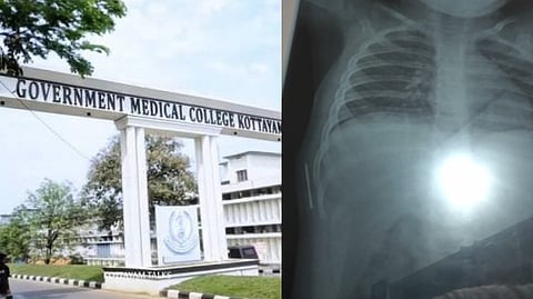 ജനിച്ചപ്പോള്‍ ഉള്ളില്‍ കുടുങ്ങിയ സൂചി! വേദനയുമായി ഒരു വര്‍ഷം; കോട്ടയം മെഡിക്കല്‍ കോളേജ് ആശുപത്രിയുടെ ഗുരുതര പിഴവെന്ന് പരാതി