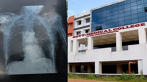കോന്നി മെഡിക്കൽ കോളേജിൽ എക്സ്-റേ മാറി നൽകിയതിൽ നടപടി; റേഡിയോളജി വിഭാഗത്തിലെ താൽക്കാലിക ജീവനക്കാരന് സസ്പെൻഷൻ